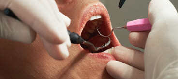 Dental checkup